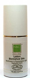 �� ���� ���� ���� 125 �"� ����� ������ NBC